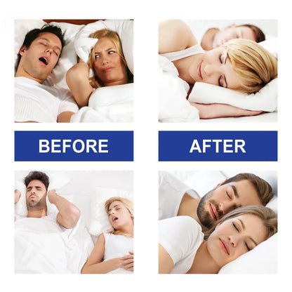 Anti-Snoring Mouth Tape - 30pcs for Nighttime Use to Improve Sleep, Reduce Mouth Breathing, and Promote Nose Breathing