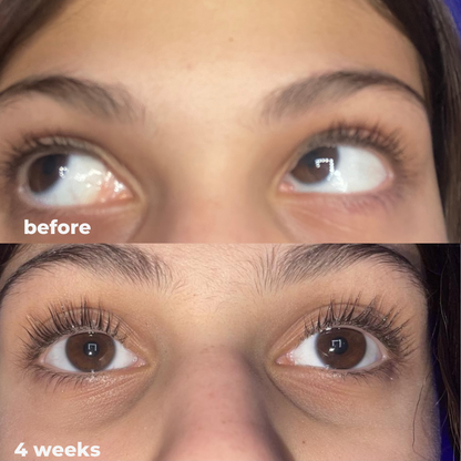 Eyelash Growth Serum - Thicker, Longer, and Stronger Lashes