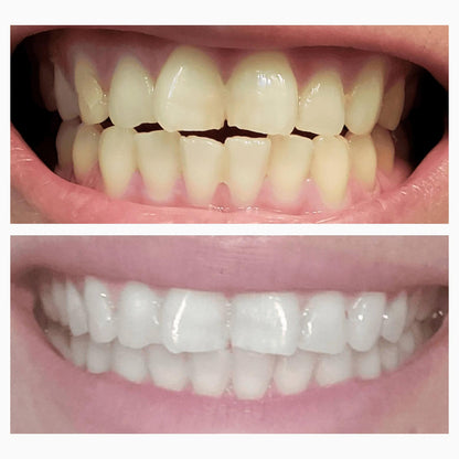 Magic Whitening Toothpaste Booster Powder - Brighten and Strengthen Your Smile