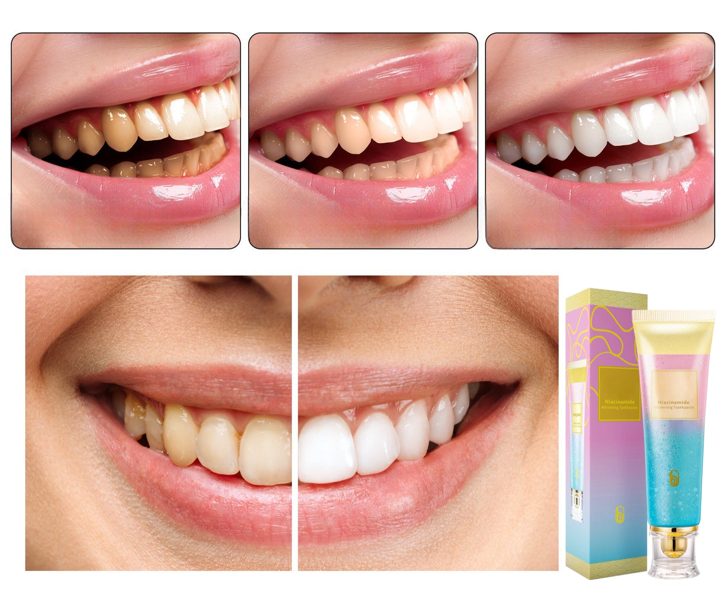 Triple Whitening Niacinamide Whitening Toothpaste – Advanced Whitening for a Brighter Smile