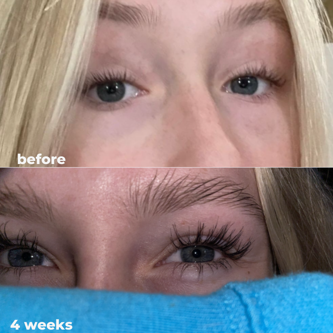 Eyelash Growth Serum - Thicker, Longer, and Stronger Lashes