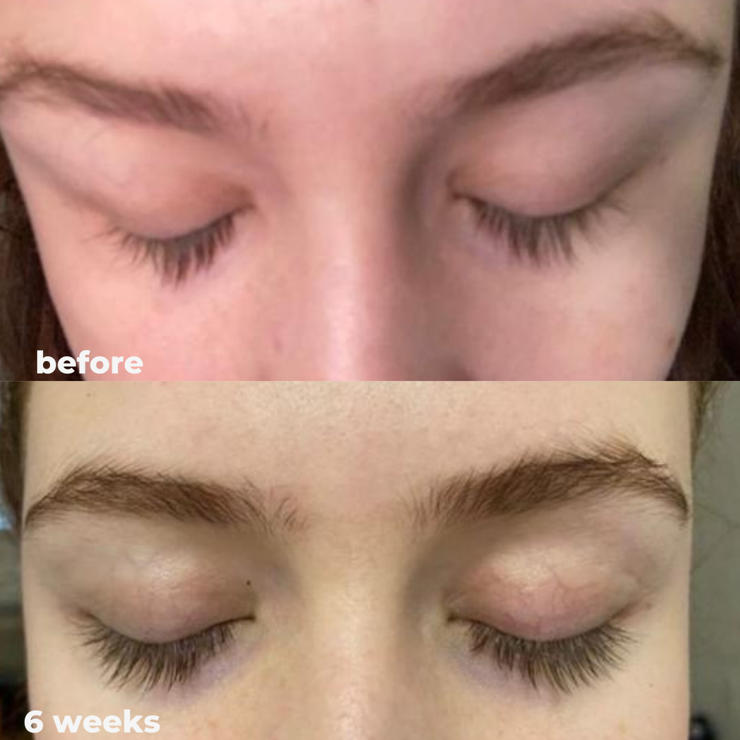 Eyelash Growth Serum - Thicker, Longer, and Stronger Lashes