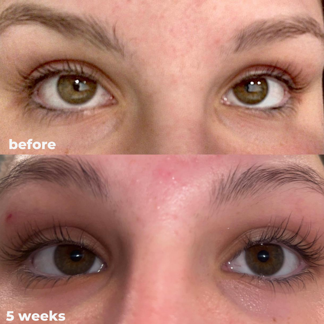 Eyelash Growth Serum - Thicker, Longer, and Stronger Lashes