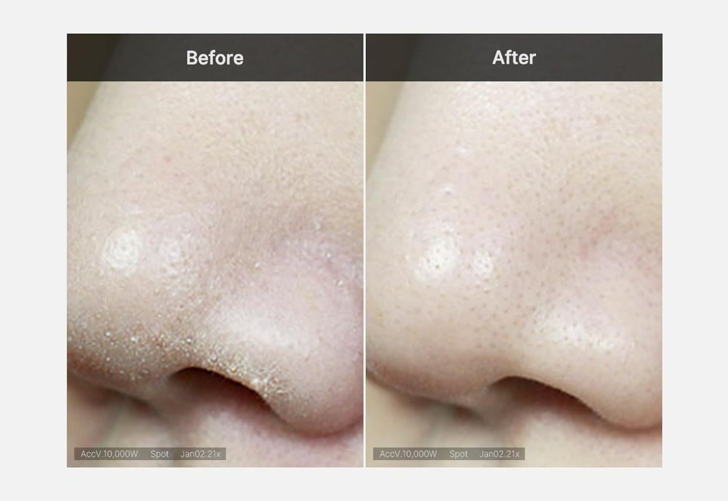 Zero Foam Cleanser - Sebum Control, Moisture Balance, and Pore Minimization