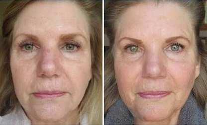 Anti-Wrinkle Moisturizer - Smooth, Hydrate, and Rejuvenate for Youthful Skin