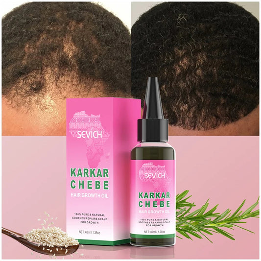 100% Natural Karkar Chebe Oil – Batana Butter & Rosemary for Hair Growth