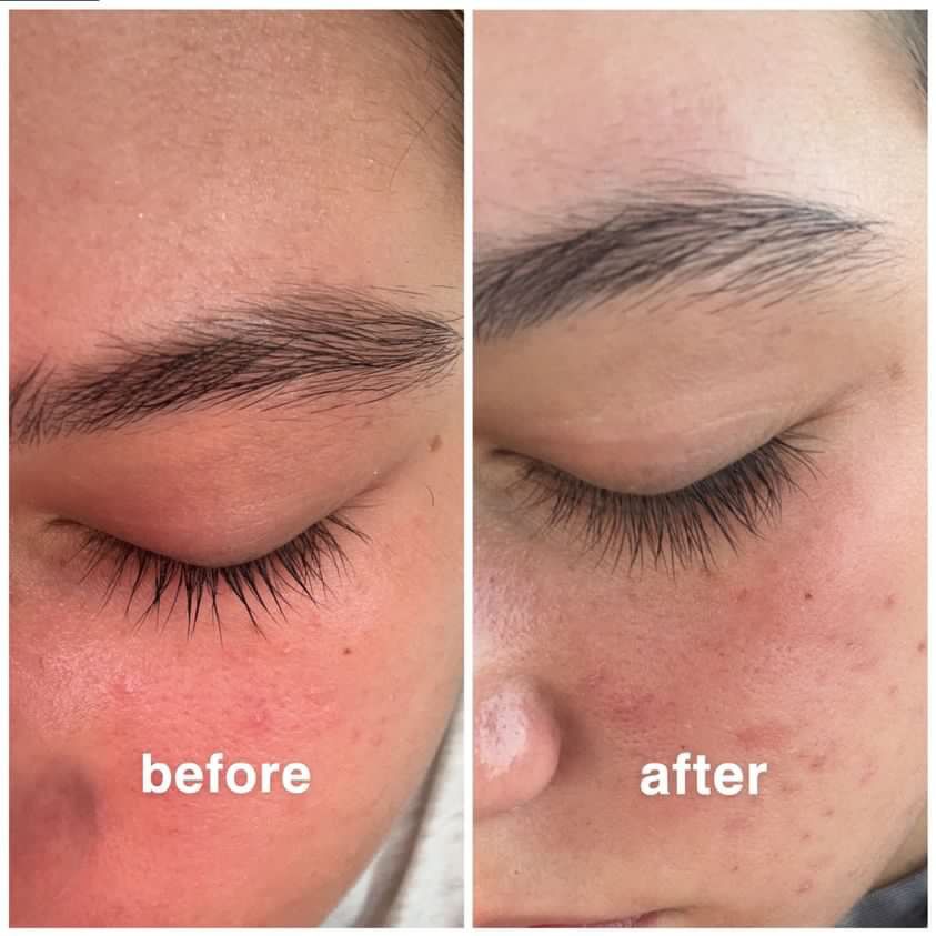 Eyelash Growth Serum - Thicker, Longer, and Stronger Lashes