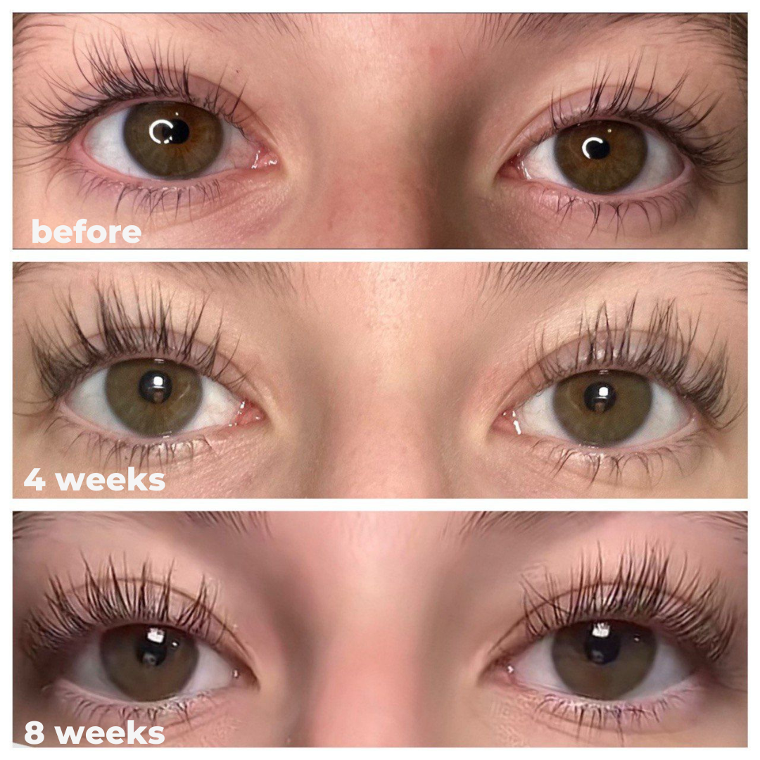 Eyelash Growth Serum - Thicker, Longer, and Stronger Lashes