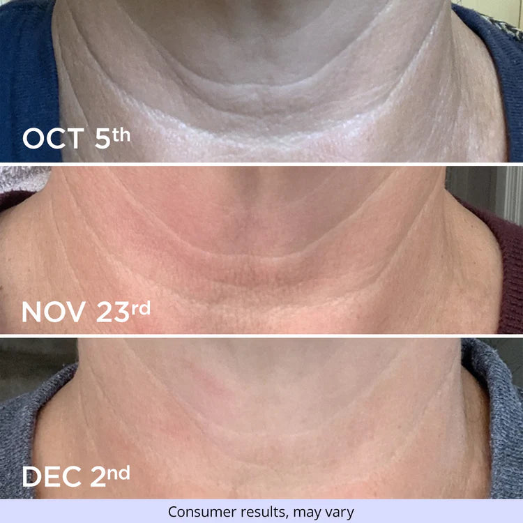 Tighten & Lift Neck Cream: Firming and Hydrating Treatment for Neck and Décolleté